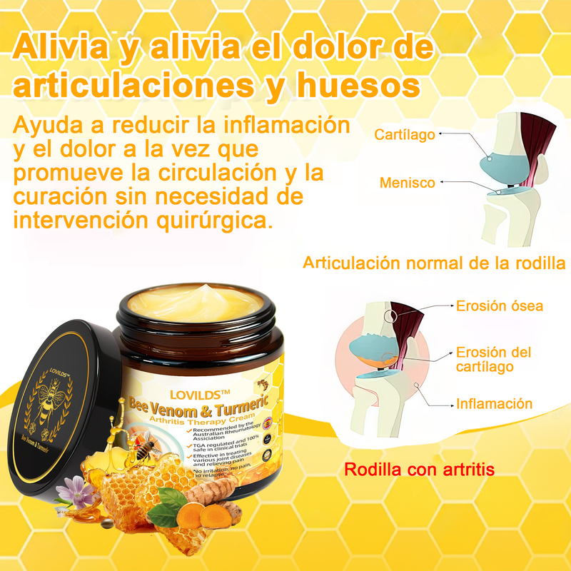 Crema para la terapia de la artritis con veneno de abeja y cúrcuma (👩‍🔬 Especializada en condiciones ortopédicas y dolor articular)